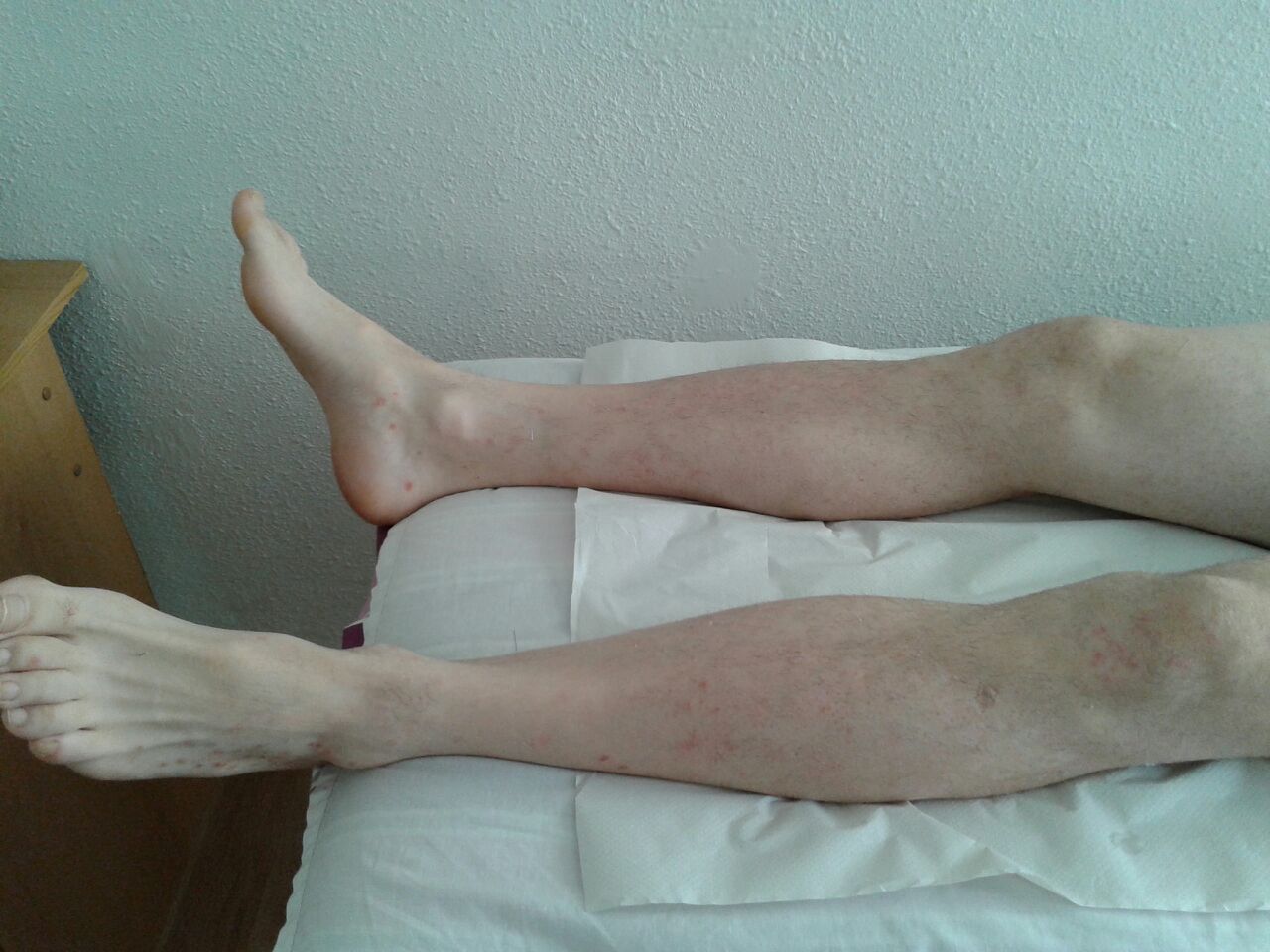 Despu&eacute;s del tratamiento